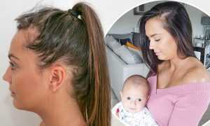 Postpartum Hair Loss