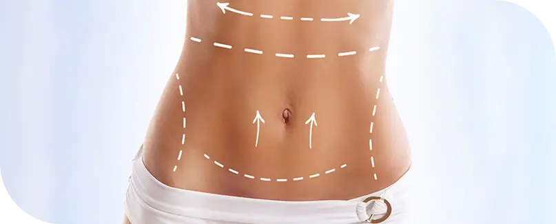 Tummy Tuck Surgery In Turkey - abdominoplasty in Turkey